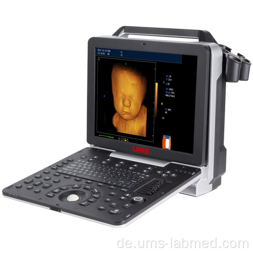 UW-P6 tragbarer Farbdoppler 4D Ultraschallscanner